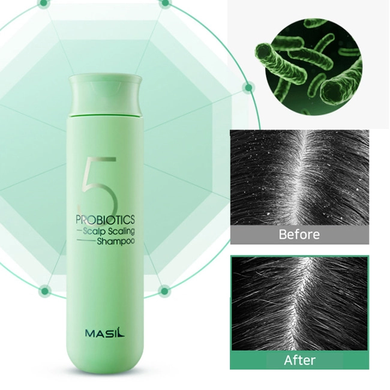 Masil 5 Probiotics Scalp Scaling Shampoo (Шампунь для глибокого очищення шкіри голови), 150 мл 8809744060569 фото